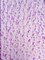 1 Yard Lilac 3D Butterfly Stretch Mesh Delicate Satin Appliqué Fabric for Dresses & Fantasy Costumes 54 Inch Wide
